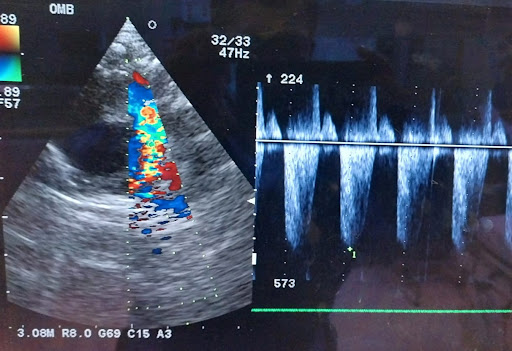 Cardiologo Pediatra -Dr. Alex Catalán